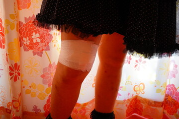 転んで太ももを怪我した為に包帯を巻いている。小学4年生女子。