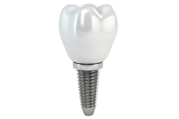 Dental implant screw, artificial white tooth, isolated on transparent background. Denture realistic closeup implant. Prosthesis, chewing denture
