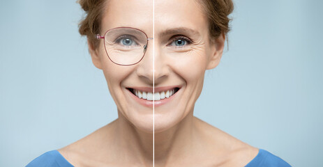 Laser vision correction. Woman face with and without glasses on blue background showing vision...