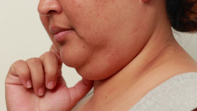 Part of face shin - Fat Womans human anatomy & Body Parts. closeup human body isolated on white background studio