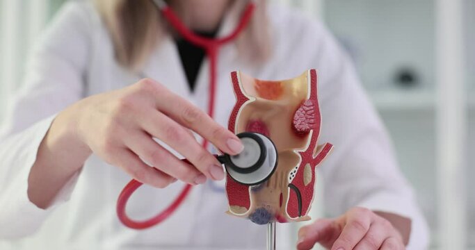 Doctor uses stethoscope to model a diseased colon to detect and diagnose colorectal cancer