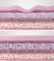 Fibroblast activation and collagen fibers regeneration in the skin extracellular matrix. Cross-section of skin tissues before and after anti-aging wrinkle reduction treatment. 3d illustration