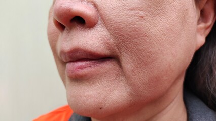 Close up the wrinkle and Flabby skin beside the mouth, dark spots and blemish on the face of the woman, health care and beauty concept.