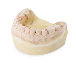 Dental model with jaw isolated on white. Cast of teeth