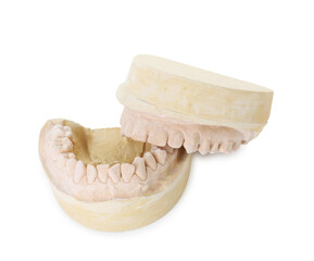 Dental model with jaws isolated on white. Cast of teeth