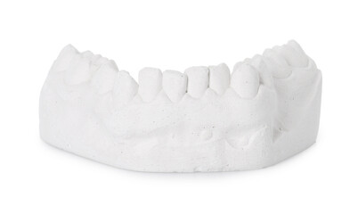 Dental model with gum isolated on white. Cast of teeth