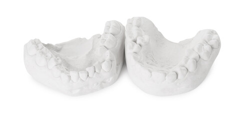 Dental model with gums isolated on white. Cast of teeth