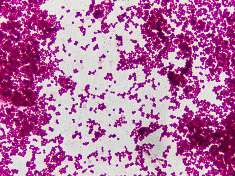 Large groups of red bacterial cells on a fixed preparation under a microscope magnification of 1000 times