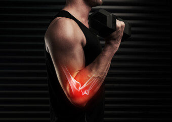 Man, arm and weight lifting with dumbbell or injury in gym with 3d anatomy for inflammation or...