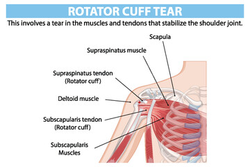Detailed anatomy of shoulder rotator cuff tear