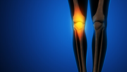 Human knee joint and bones with inflammation