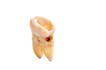 Close-up of extracted tooth with clipping path isolated on a white background.  Macro photograph, real human teeth, tooth with caries