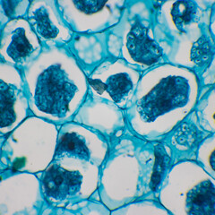 This is a photomicrograph of corn seeds.This photo focuses on the germ sheath cells of corn.Magnify...
