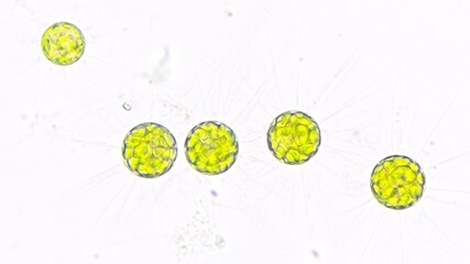 Freshwater microalgae, Golenkinia sp. Live cell. Selective focus image