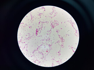Bacteria cell gram neagtive bacilli.