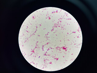 Bacteria cell gram neagtive bacilli.