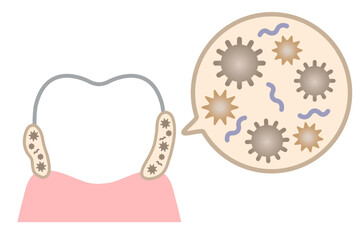 歯のバイオフィルム