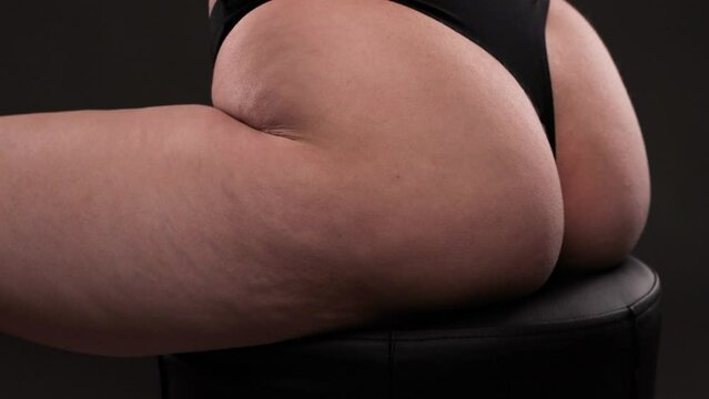 Fat woman with cellulite on her legs. Obese woman in white underwear.Overweight treatment.