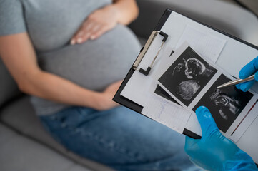 Naklejka premium Gynecologist looks at an ultrasound of a pregnant woman. 