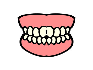 審美歯科、白い歯の入れ歯イラスト素材