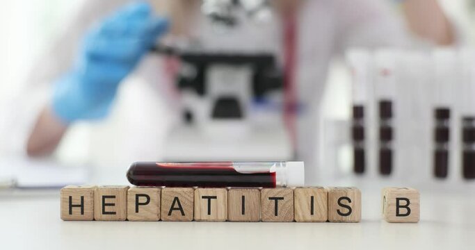 Hepatitis B blood test in vitro in laboratory