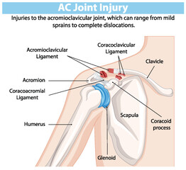 Detailed illustration of shoulder joint anatomy