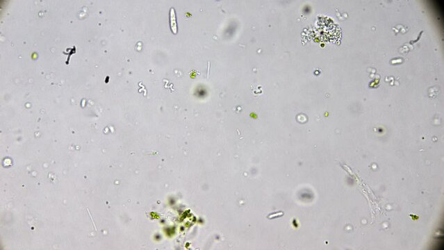 Experience the intricate ecosystem within a single water droplet, where tiny beings like paramecia and spirulina are visible under a microscope.