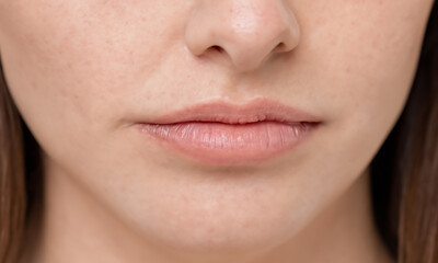 Obraz premium Close up view of caucasian woman's face, nose, lips, cheeks. Unrecognizable person. Beaty industry, skincare concept, 