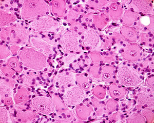 Dorsal root ganglion neurons