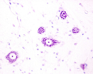 Spinal cord. Motor neurons of anterior horn