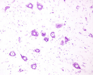 Spinal cord. Motor neurons of anterior horn