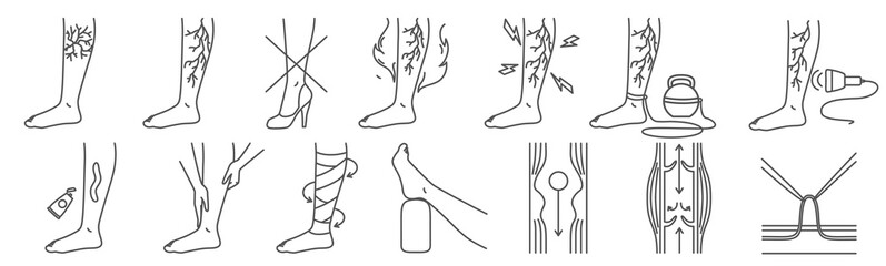 Varicose vein disease symptom, treatment medical infographics elements. Outline patient legs with different advice to prevent disorder development and to cure vessel inflammation vector illustration