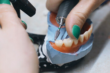 A dental technician cleans dentures with a milling cutter in the laboratory.