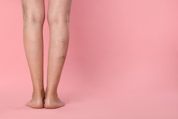 Closeup view of woman with varicose veins on pink background. Space for text