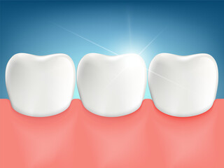 Dental teeth whitening. Tooth veneers. Stock vector illustration