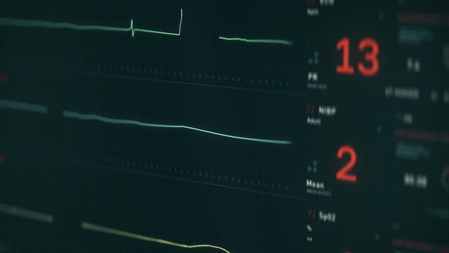 Medical electronic device shows the pulse graph. Electronic pulse monitoring graph slowly rises from a flatline. Electronic system displaying the pulse graph identifying the resurrection of a patient.