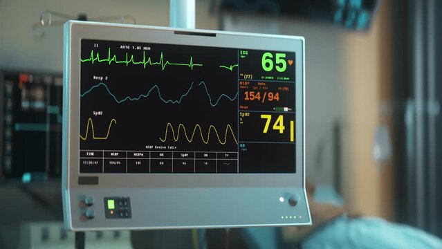 Electronic pulse monitoring system is checking the vital signs of the patient. Electronic monitoring system is measuring the pulse. Electronic monitoring system detects a rapid decrease in the pulse.