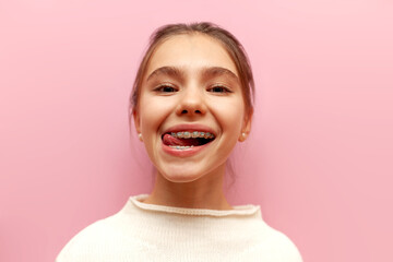cheerful teenage girl with braces showing tongue and fooling around on pink isolated background,...