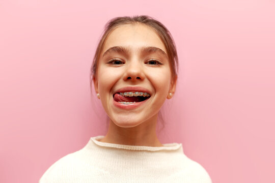 cheerful teenage girl with braces showing tongue and fooling around on pink isolated background, child licking teeth with open mouth