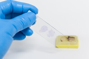 Scientist wear blue glove holding slide and out of focus paraffin human tissue block on white...