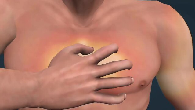 Heart attack treatment