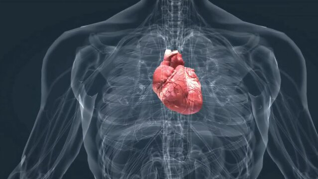 Heart attack 3d animation