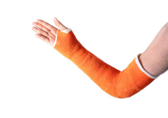 hand in an orange fiberglass cast after a fracture of the wrist bones for fixation on a white...