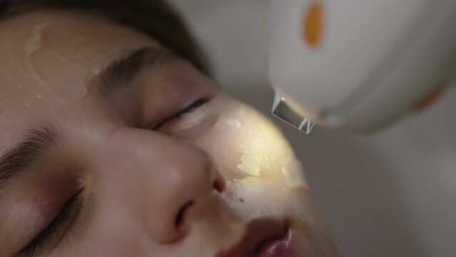 A woman receives IPL therapy in a beauty salon.