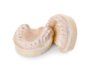 Dental model with jaws isolated on white. Cast of teeth