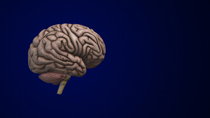 Brain bleed or an intracranial Hemorrhage