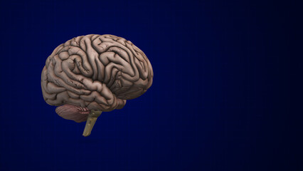 Brain bleed or an intracranial Hemorrhage