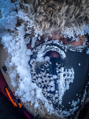Look of a person with ice on his face