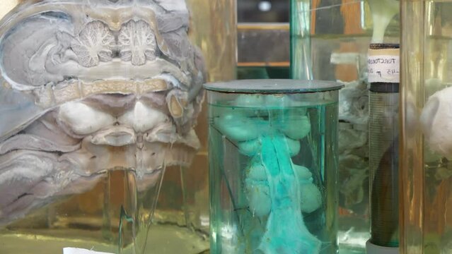 Animals internals in glass jars with formaldehyde for medical research, among which the sagittal section of calf head. Animals internal organs