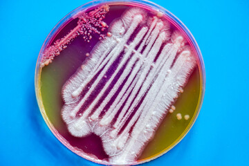 Petri dish inoculated with bacteria from farmer's cheese
